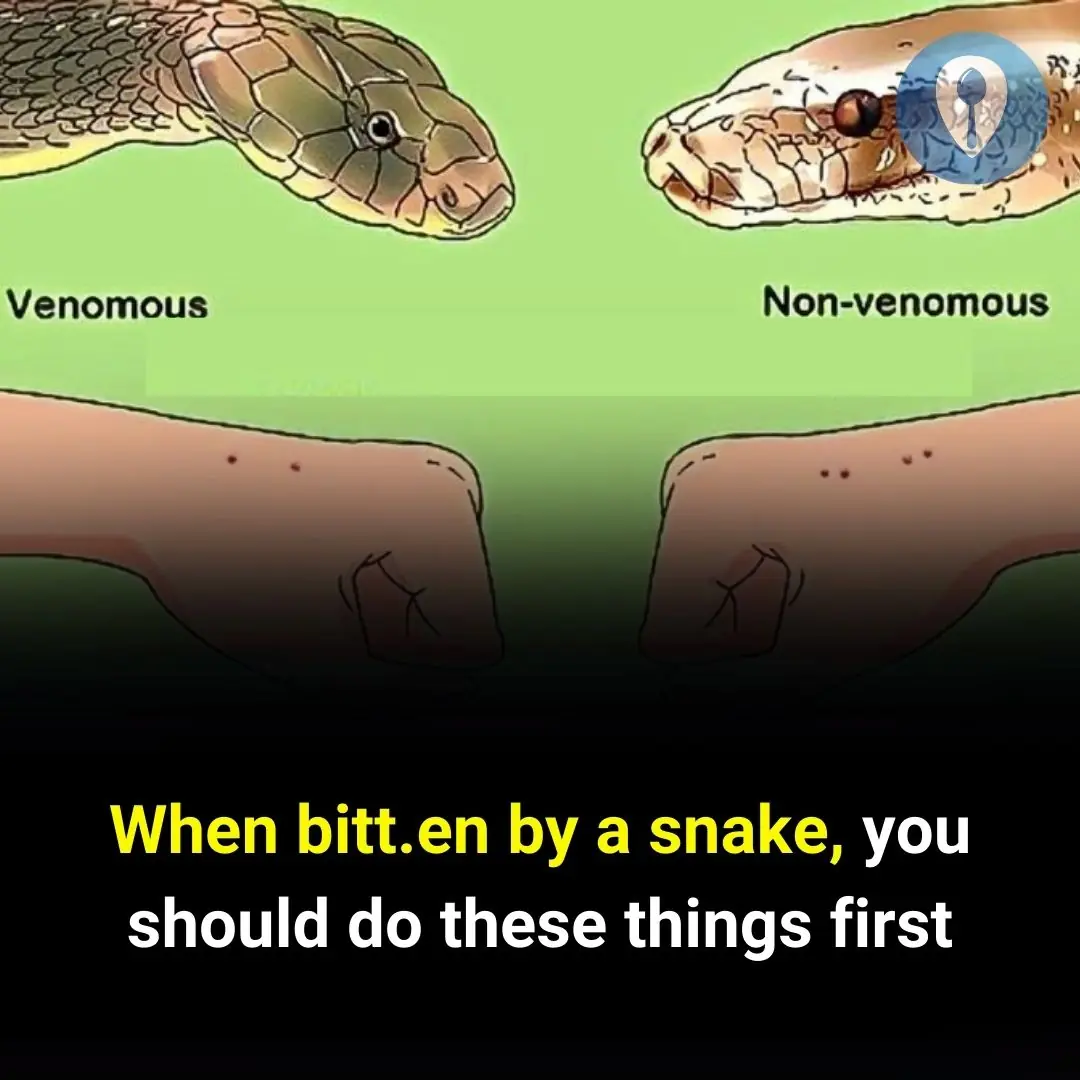 When bitten by a snake, you should do these things first